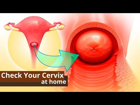 वीडियो: अपने गर्भाशय ग्रीवा को कैसे महसूस करें: 9 कदम (चित्रों के साथ)
