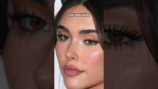 MADISON BEER – warum ihre NASE zu 100% OPERIERT wurde!! #plastischechirurgie #nasenkorrektur