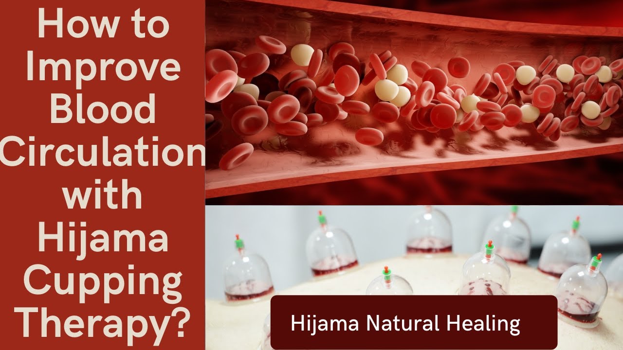 How to improve blood circulation with Hijama Cupping Therapy? blood circulation with Cupping Therapy