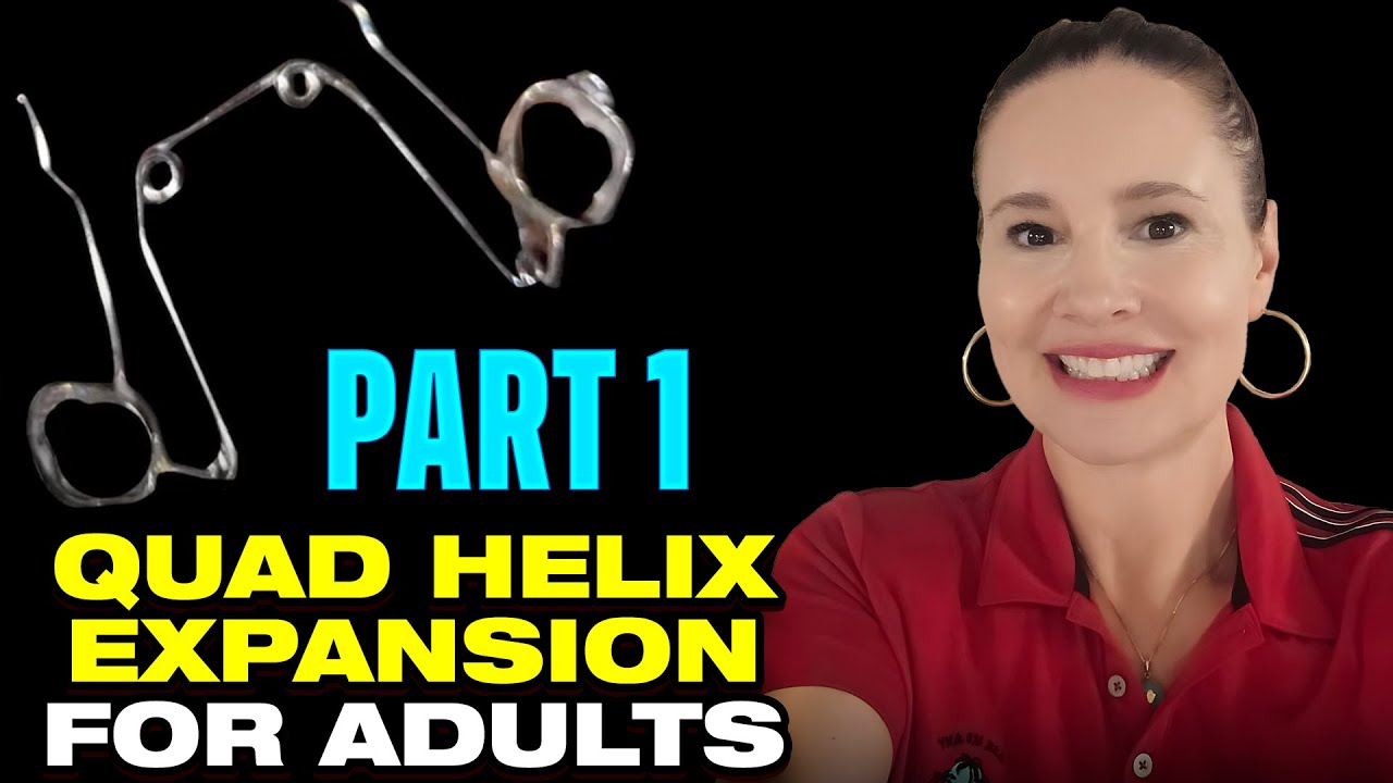 What is the Difference between a Quad Helix and an Expander or RPE