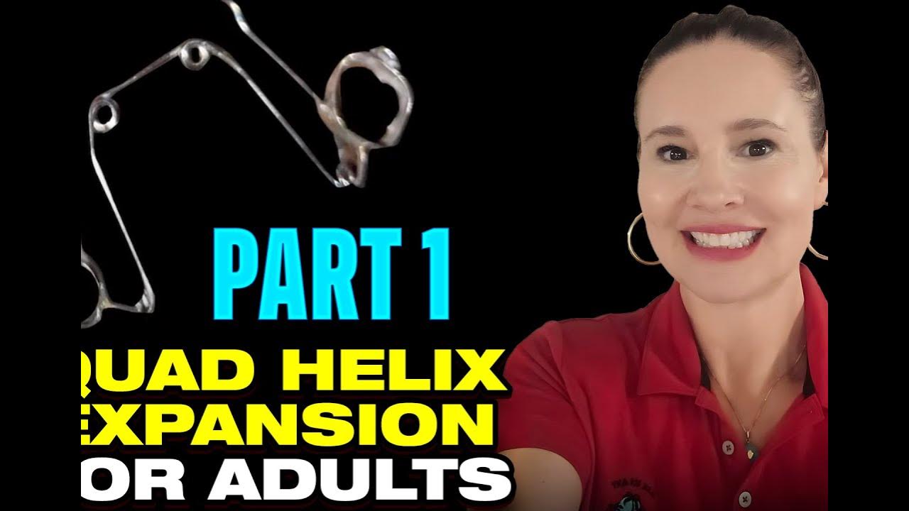 What is the Difference between a Quad Helix and an Expander or RPE