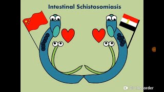 Schistosoma mansoni (Blood Fluke) - Intestinal Schistosomiasis/Bilharziasis البلهارسيا