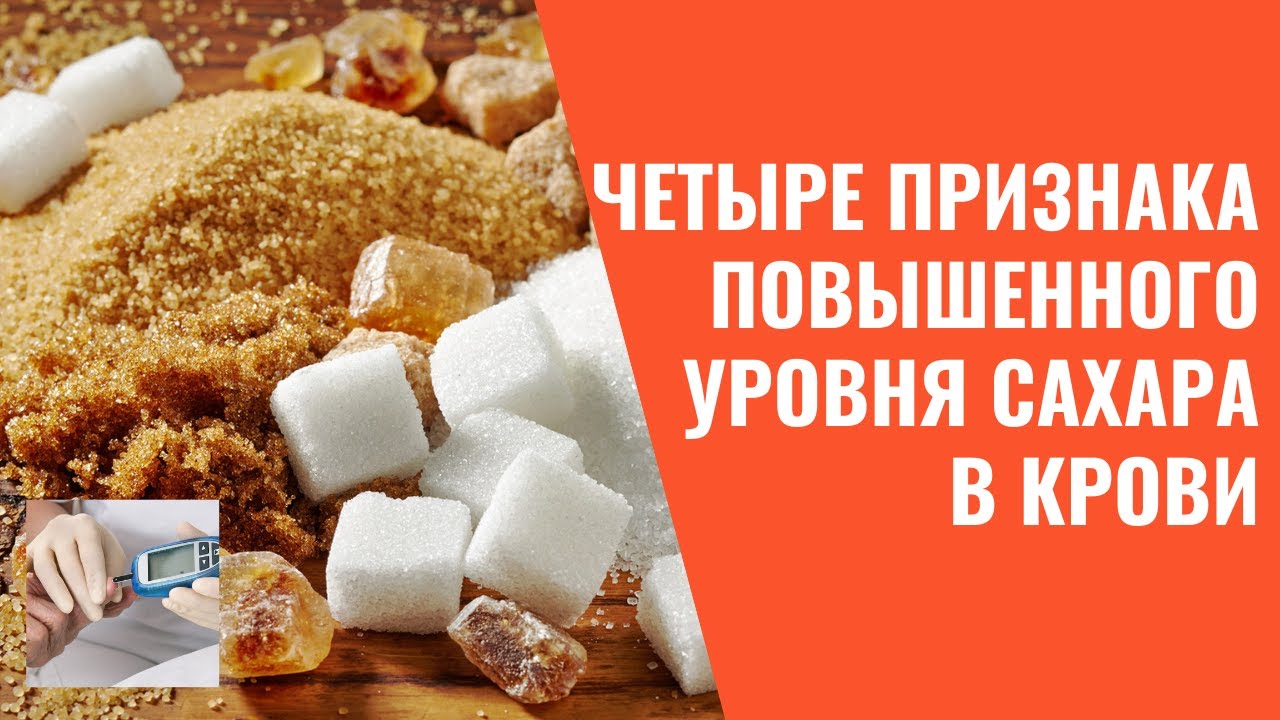 Признаки повышения сахара. Продукты повышающие сахар.