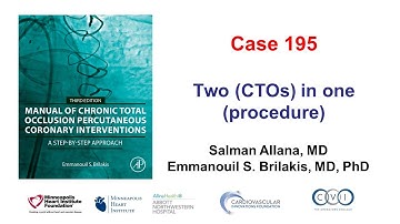 Case 195: Manual of CTO PCI - Two (CTOs) in one (procedure)