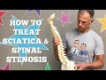 How to Treat Sciatica AND Spinal Stenosis (or Spondylolithesis)