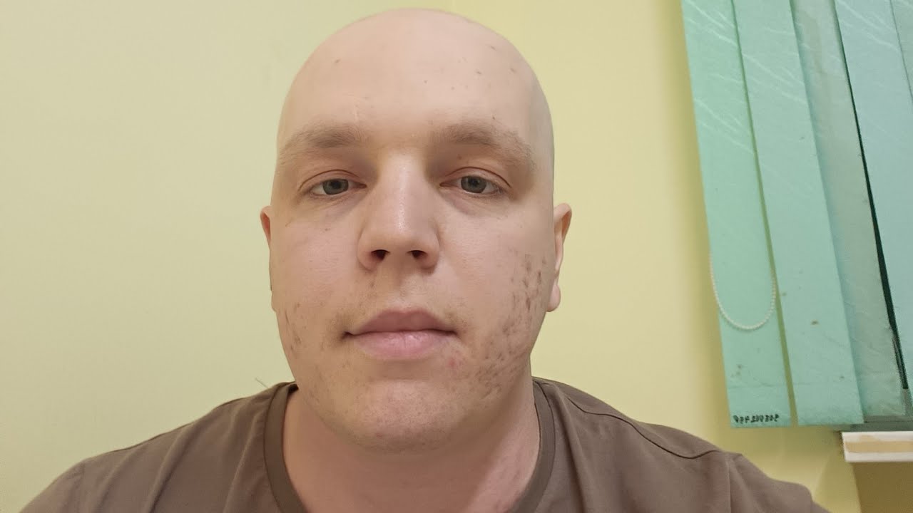 Результаты КТ, как всегда всё не одназначно. - YouTube