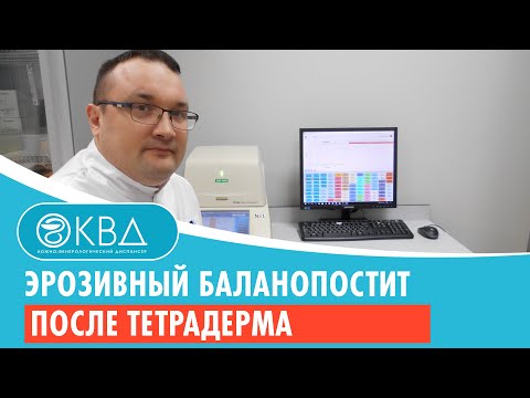 💣 Эрозивный баланопостит после тетрадерма. Клинический случай №270