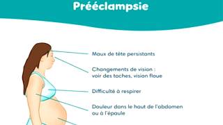 PREECLAMPSIA: THE SILENT KILLER ACCOUNTING FOR 24.3% OF MATERNAL DEATHS IN CAMEROON