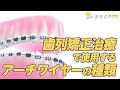 歯列矯正治療で使用するアーチワイヤーの種類【材質・形・色】