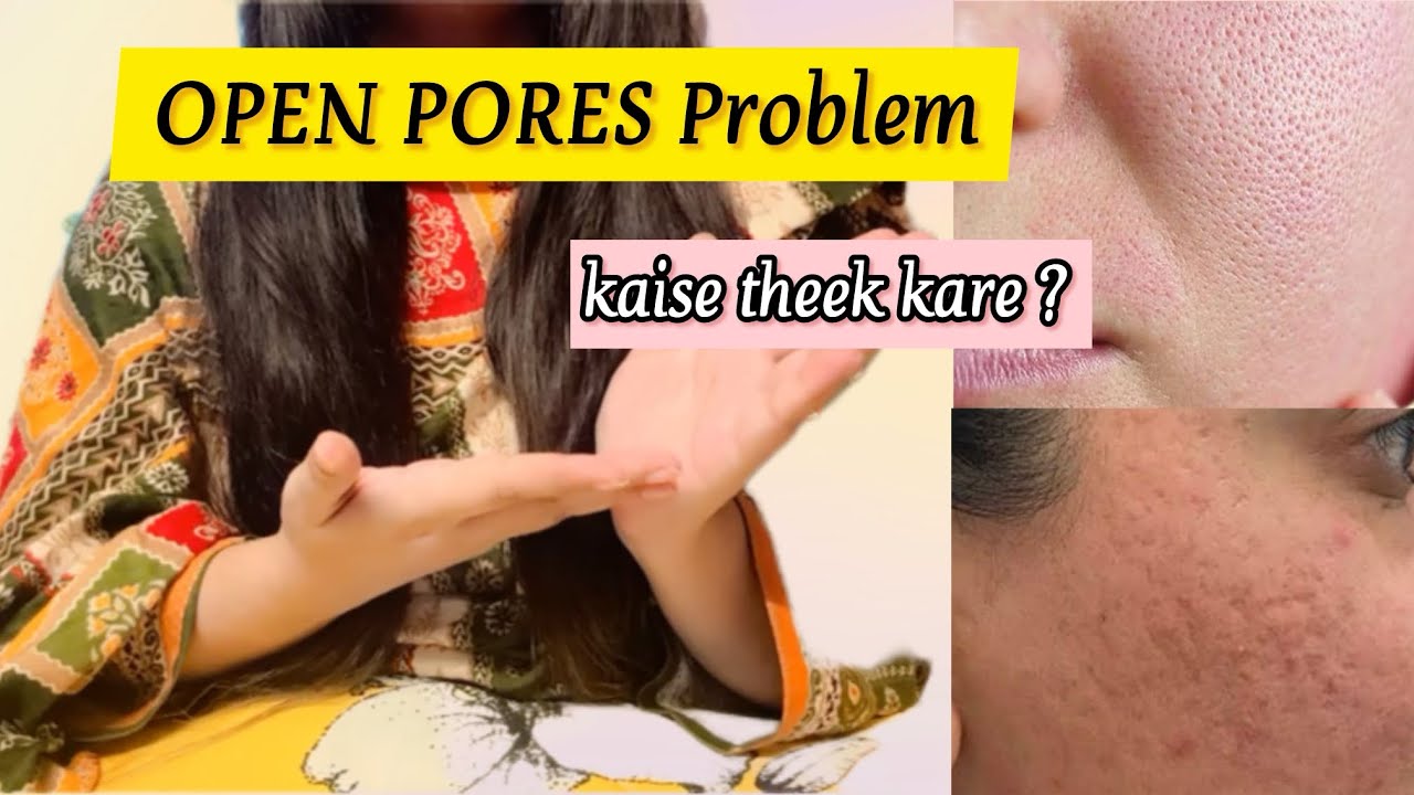 Open pores ki problem | Ab hogi door try my routine 🤗