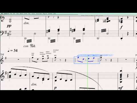 Sibelius 6 Quick Tip 4: Creating Ornaments