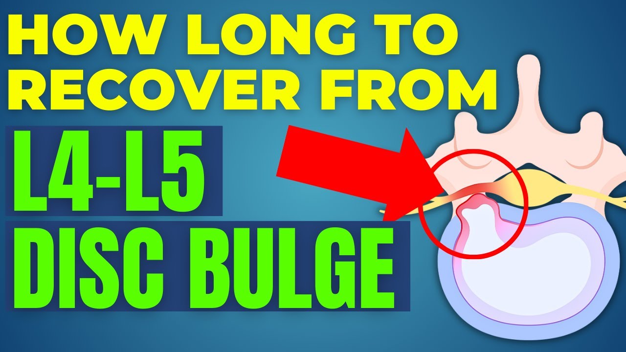 Восстановление после протрузии межпозвоночного диска L4–L5: сколько времени потребуется, чтобы по...