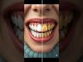 Photoshop Teeth Whitening Tutorial | Fix Yellow Teeth Fast &amp; Realistic #photoshop