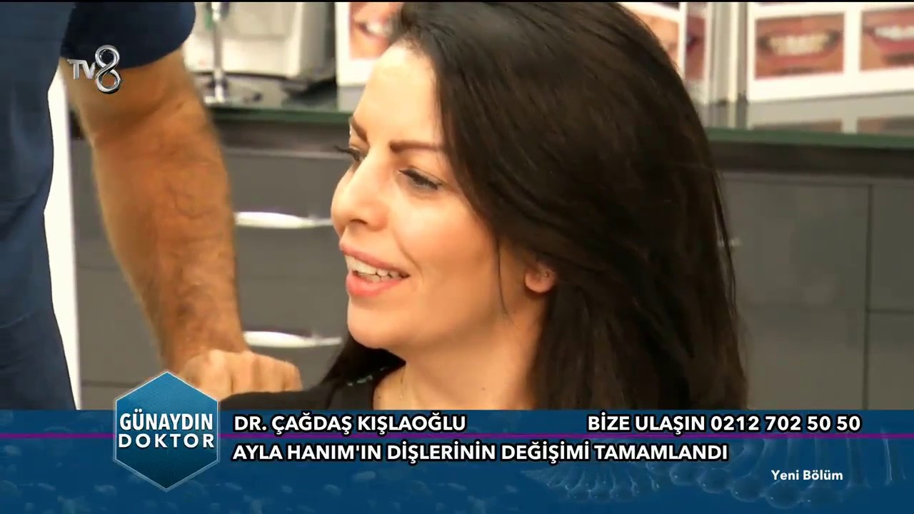 Diş Beyazlatma ve Bonding İşlemi Nasıl Yapılır ?