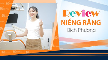 [Review niềng răng]: #141 Kết quả niềng răng của Bích Phương