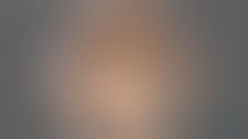 Laparoscopic Resection of Gastric GIST: a Simplified Approach