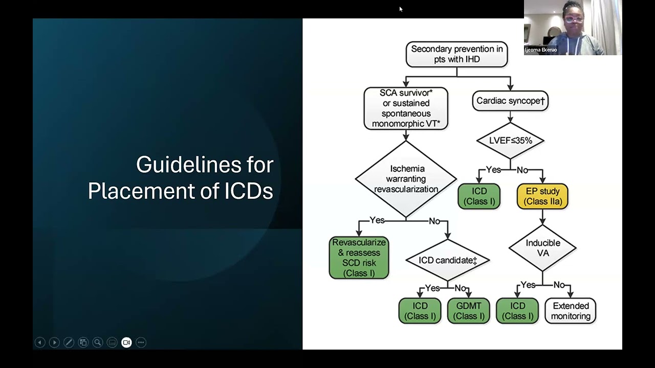 All You Need to Know About Implanting ICDs and CRTs (in 50 min) - CVEF - Cardio Basics Series