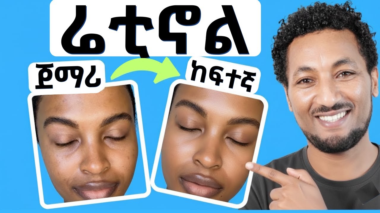 መሸብሸብን ታሪክ የሚያደርጉ ሬቲኖሎች/Retinol-The #1 Anti-Aging Ingredient