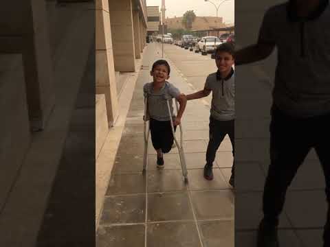 ويه ويه صالح جاء بعكازات ويه ويه تقليد عيوش جت ويه ويه