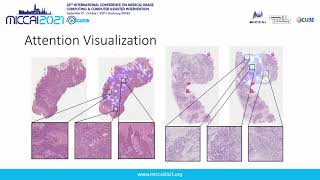 Pay Attention with Focus: A Novel Learning Scheme for Classification of Whole Slide Images