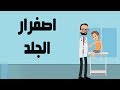 اصفرار الجلد