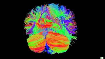 Human Brain Connectivity (DTI) - 20 year old female