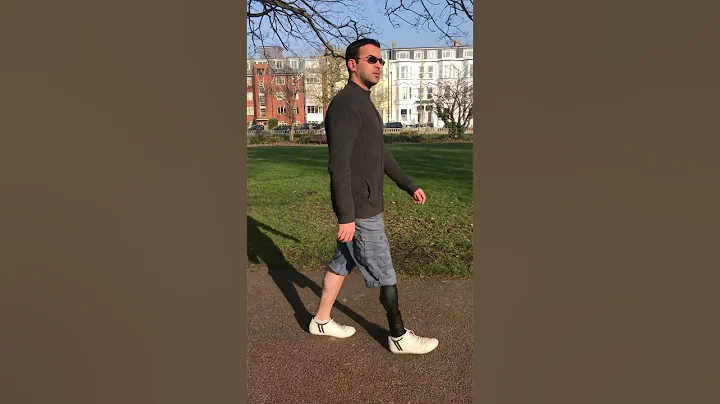 Right above knee amputee Genium X3 part 1