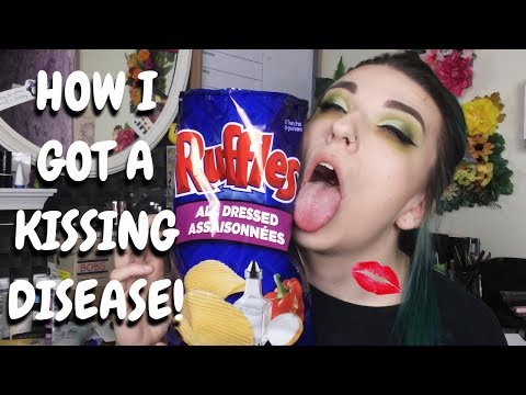 How I Got Mono *Kissing Disease* | Storytime