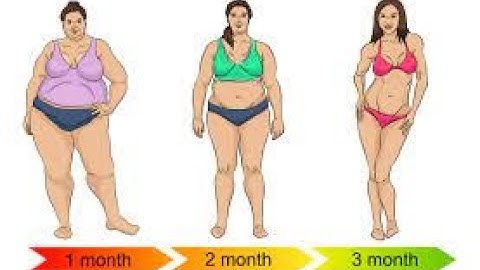 Weight loss surgery CPT code - simplify medical coding