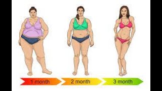 Weight loss surgery CPT code - simplify medical coding