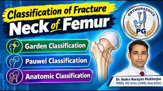 Fracture Neck of Femur - classification explained