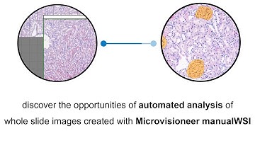Deep Learning Automated Glomerulus Analysis of Microvisioneer manualWSI Scan