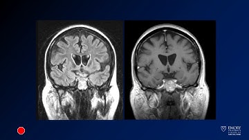 Neuroradiology board review lecture 1 case 1