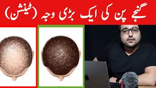 Dr. Zee:The Most Common Cause of Hair Loss