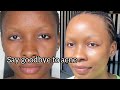 Affordable Skincare Routine For Sensitive Skin (Say Good-bye To Acne)