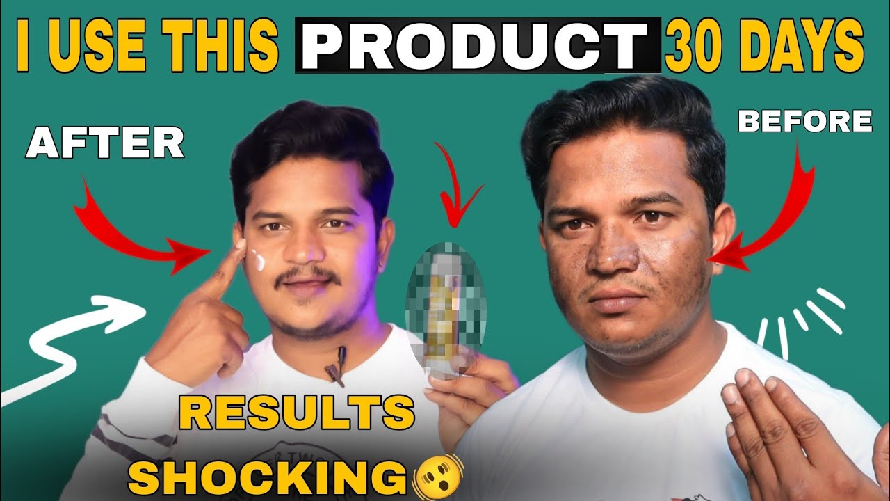 I USED THIS PRODUCTS FOR 30 DAYS RESULTS SHOCKING😱ఈ ప్రొడక్ట్ 30 రోజులు