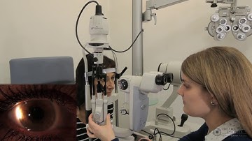 Slit Lamp Techniques   Sclerotic Scatter