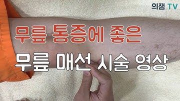 무릎 통증에 좋은 무릎 매선 치료 설명과 실제 시술영상 보여드립니다!