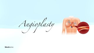 The word  Angioplasty
