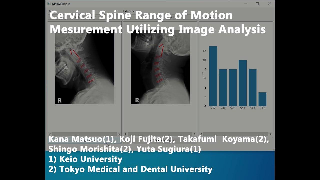 Cervical Spine Range of Motion Measurement Utilizing Image Analysis