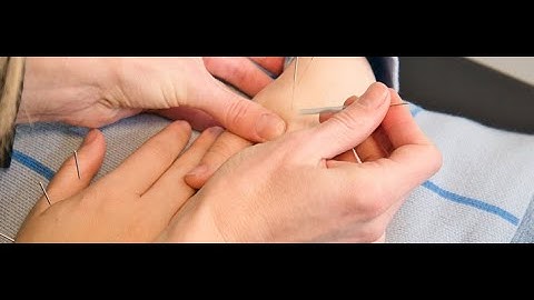 YUAN SOURCE & XI CLEFT POINTS: Quiz