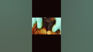 Tác hại khi hút thuốc lá 🚬. Cre: Tik Tok #health