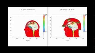 Traumatic Brain Injury