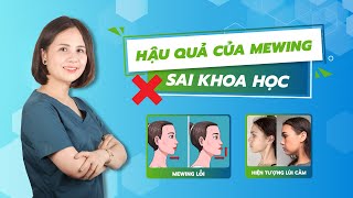 5 HIỆU ỨNG KINH KHỦNG KHI TẬP SAI MEWING VÀ CÁCH KHẮC PHỤC screenshot 2