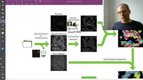 Lecture 8.1: Watershed Algorithm | Clinical Application | CVF20