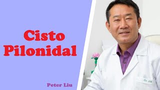Cisto Pilonidal