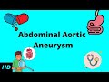 Abdominal Aortic Aneurysm, Causes, Signs and Symptoms, Diagnosis and Treatment.
