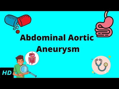 Video: Abdominal Aortaaneurisme - Symptomer, Behandling, Kirurgi, Brud