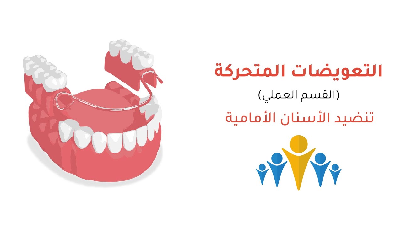 تنضيد الأسنان الأمامية العلوية و السفلية