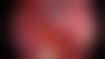 Asvide: Right lower lobectomy: steps and technical tricks